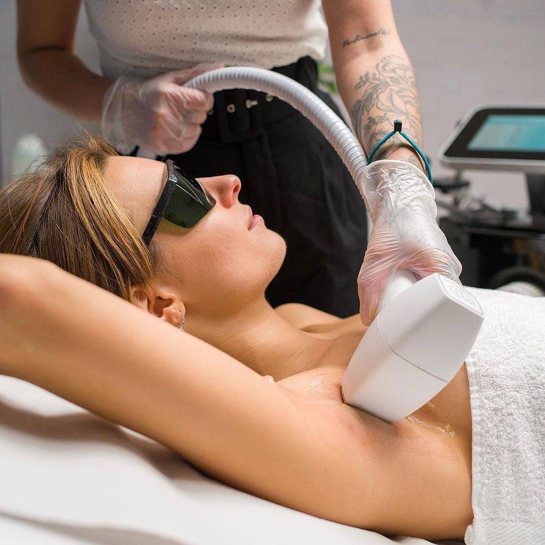 Laser Hair Removal in Corona CA for Men and Women