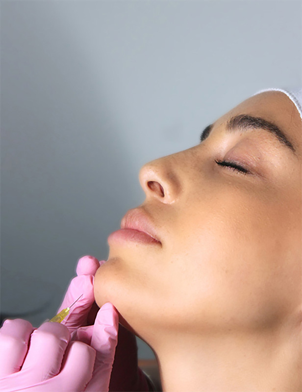 Chin Fillers the body bar medical spa corona ca