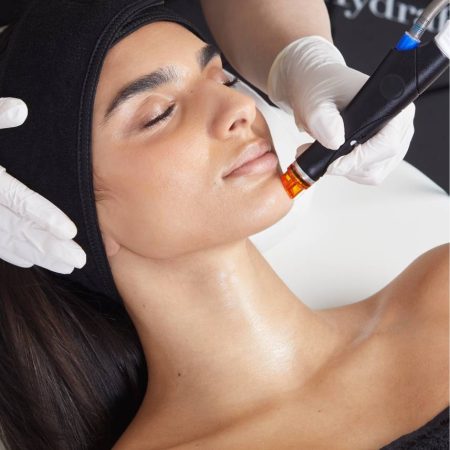 Hydrafacial in Corona, Ca